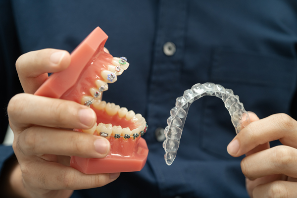 How Is Invisalign® For Teens Different Than Invisalign® For Adults?